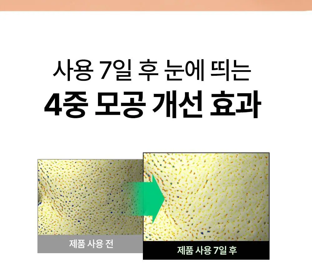 [트러블/잡티] 듀이트리 AC 딥 진정 패드 2종 택1 (모공/미백) 상세페이지 26